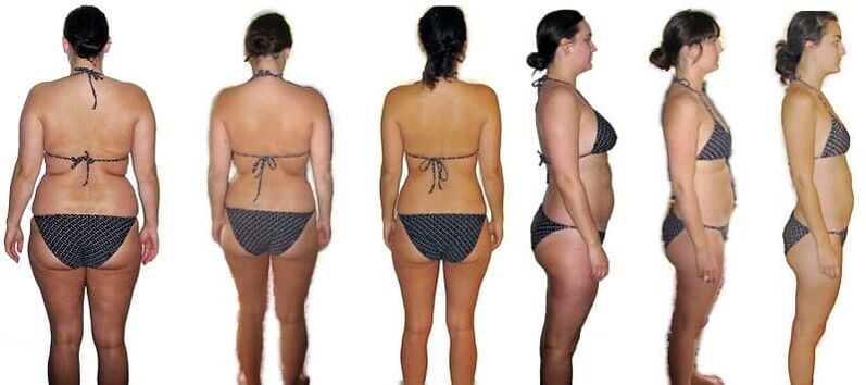 Before and after weight loss
